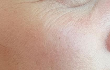 Which Serum Can Help With Fine Lines and Early Signs of Aging?