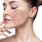 The Skincare Problem Nobody Talks About: A Damaged Skin Barrier