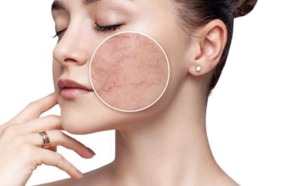 The Skincare Problem Nobody Talks About: A Damaged Skin Barrier